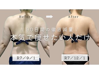 アリスビューティプラス(Alice Beauty+)/確実に落とす９０日間減量コース