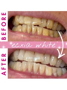 エクシアホワイト 倉吉店(ecxia white)/ビフォーアフター