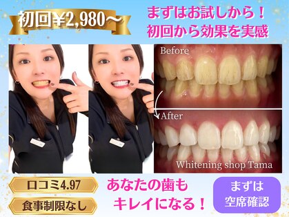 ホワイトニングショップ 多摩店の写真