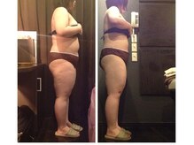 プラチナアース つくば店(Platinum earth)/痩身ビフォーアフター