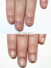 マリーロール 梅田店(Marie Laure)/自爪育成/深爪矯正/ネイルケア