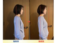 キワミ(KIWAMI)/＃整体＃恵比寿＃首専門