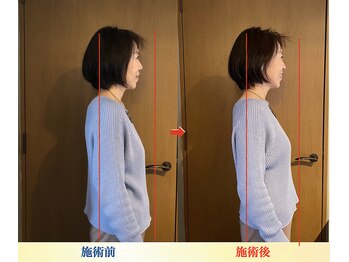 キワミ(KIWAMI)/＃整体＃恵比寿＃首専門