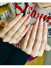 チヒロネイル/縦長ネイルベットスカルプ