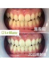 ルブラン 奈良店(Le Blanc)/20回保証コース！