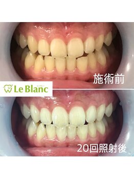 ルブラン 奈良店(Le Blanc)/20回保証コース！