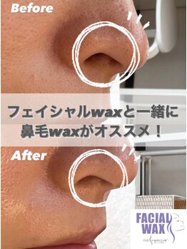 エリス(ELISSE)/鼻毛waxも出来ます！