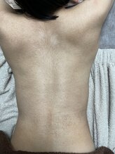 カルム(calm.)/背中シュガーリング前