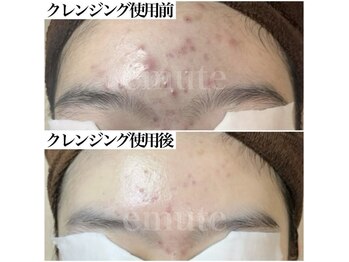 アンビワン(Anbione.)/クレンジングはスキンケア★