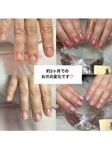 ビエル(美elu)/自爪育成コース
