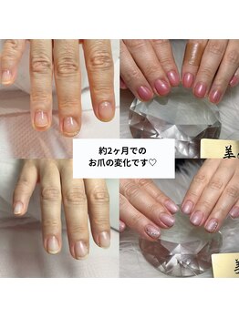 ビエル(美elu)/自爪育成コース