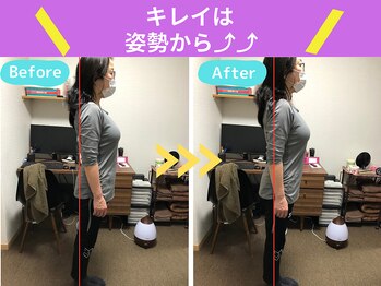 京都中丸整体カイロプラクティック/猫背