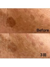 シュシュエステプリューム(Chou Chou Esthe PLUME)/