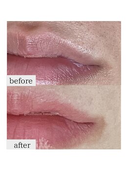 テセラ(Tethere)/ローマピンク