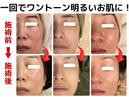アロマベアー(Aroma Bear)の写真