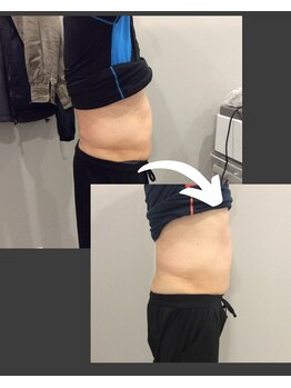 トラレス(Trouless)/筋力UP