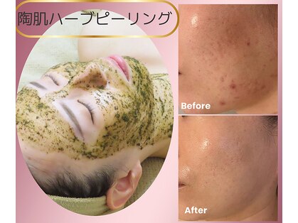 ヘブンビューティー(Heaven Beauty)の写真