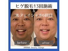 アマナ(AMANA)