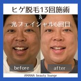 アマナ(AMANA)