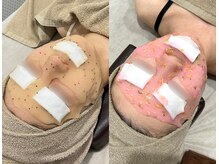 TD 鵜沼店/ハイドロジェリーマスク