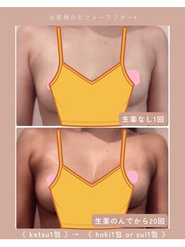 アイン 銀座(Ain)/バストアップ例１ ブラなし谷間