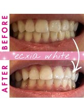 エクシアホワイト 倉吉店(ecxia white)/ビフォーアフター