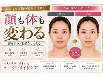 アプロ(Aphro)の写真/結果で選ばれる全身痩身×小顔ケアで理想のボディへ