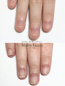マリーロール 梅田店(Marie Laure)/自爪育成/深爪矯正/ネイルケア
