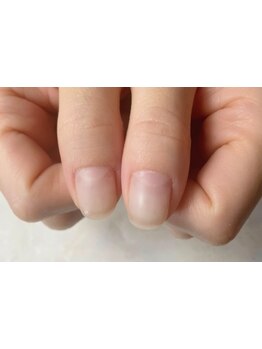 爪の悩みを解消できる（ケア含む）