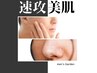 【メンズ脱毛 】ヒゲ脱毛+鼻の毛穴洗浄ハイドラ 顔マッサージ付き 新規4400円