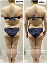 ビンナ 五反田店(Binna)/美骨矯正