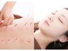 新規40%OFF！【特別セットコース】自律神経調整＋美容鍼￥14500→8800