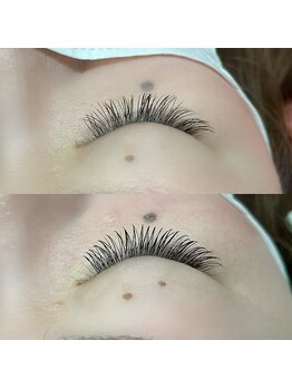 アロンジー(Allonsy)/上前回から4週間後下リペア後