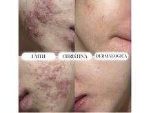 バイオラックスビューティー 大塚店(BIOLUXE BEAUTY)の雰囲気（根本からの改善を。症例写真はフォトギャラリーをご覧ください）