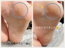 グランボヌール(grand bonheur)/【フット角質ケア♪】