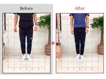トリコ(Torico)/O脚/X脚の改善も実績があります