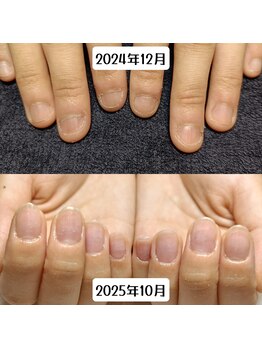マニエネイル(mani e nail)/10ヶ月で変わる私の自爪成長記録