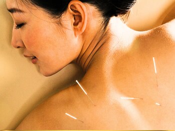 トゥルン(Tworun)/鍼灸+マッサージ