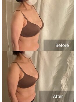 ハートランド(HEARTLAND)/泉中央姿勢矯正 泉中央肩こり