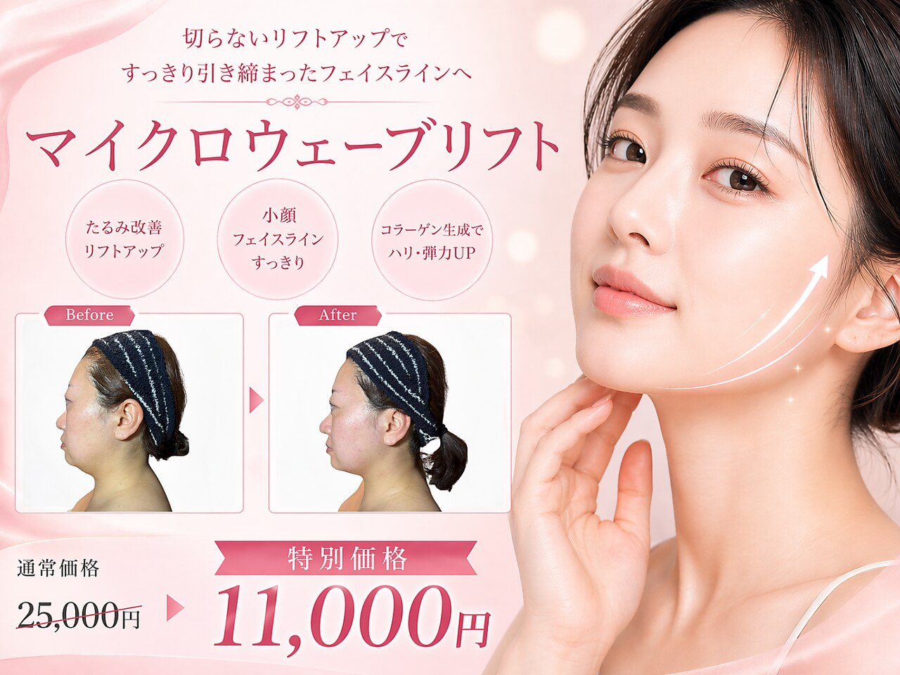 大阪駅でエレクトロポレーションが人気のエステサロン｜ホットペッパー