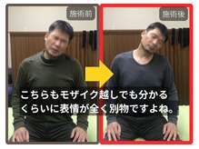 まこと整骨院/ずっと取れない長引く肩の痛み５