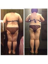 プラチナアース つくば店(Platinum earth)/痩身ビフォーアフター