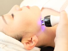 オプレア 栄店(OPREA)/ハイパーナイフ(顔)