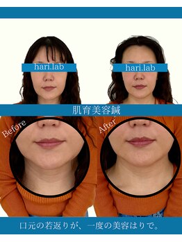 ハリラボ(hari Lab.)/【お客様の声】