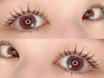 リトマス(LITMUS)