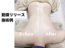 イロドリ ボディ アンド フェイス(irodori. body & face)の雰囲気（4D筋膜リリースなら気になるボディラインも即スッキリ♪）