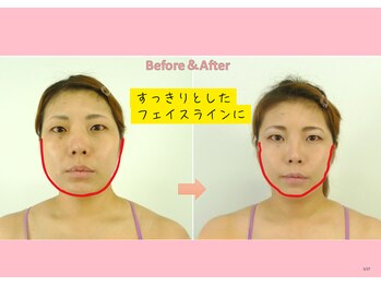 円山カラダ/スッキリとしたフェイスラインに