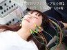 【学割U24】★初回【美容鍼リフトアップ＆小顔】初回¥2,400
