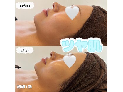 アンドリノ(&LINO)の写真