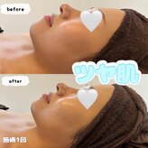 アンドリノ(&LINO)